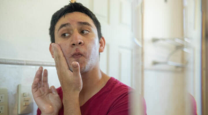 teenager with acne